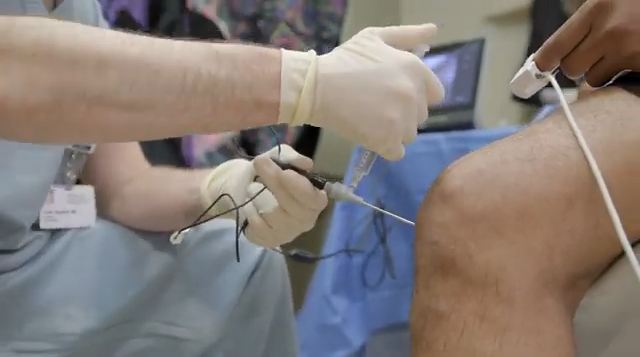 New Minimally Invasive Surgery: The Nano Experience